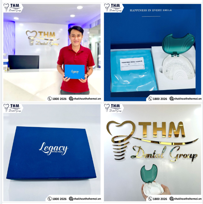 KHÁCH HÀNG NHẬN KHAY NIỀNG RĂNG TRONG SUỐT LEGACY (SẢN XUẤT TẠI VIETNAM)