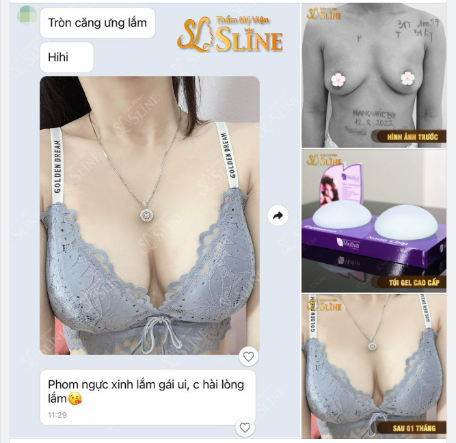 Khách hàng ưng ý hài lòng về kết quả, là sự khẳng định thương hiệu Thẩm Mỹ Viện Sline trong bao năm qua.