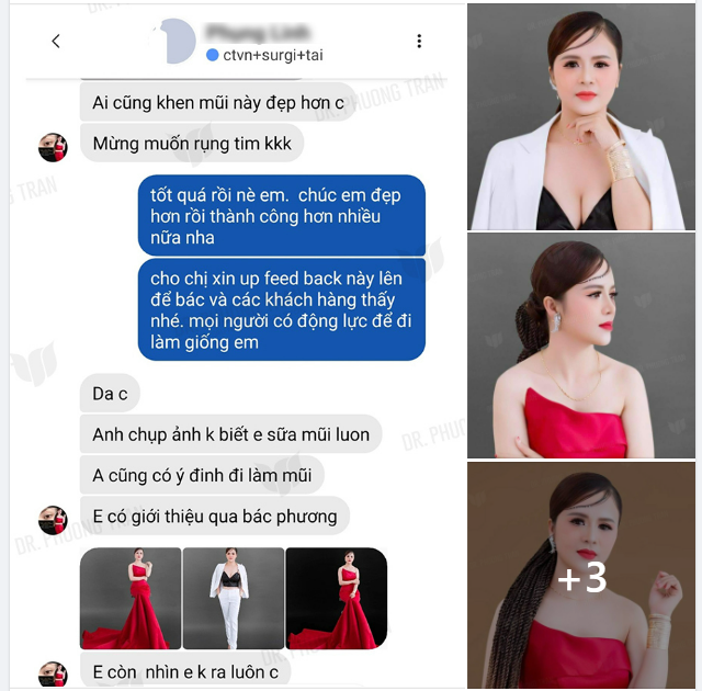 Khi BOSS LÀM ĐẸP chọn nâng mũi thì cũng rất kỹ càng