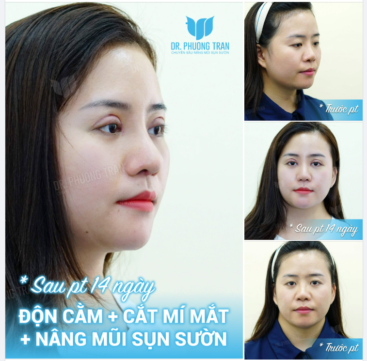 Không cần làm hoa để rực rỡ nổi bật. Làm lá thôi và lặng lẽ xanh…!