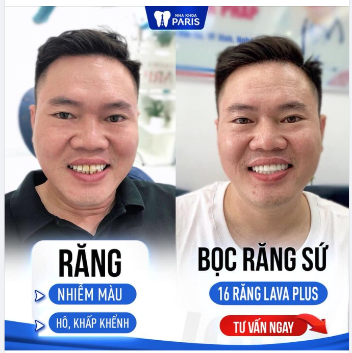 LÀM RĂNG ĐẦU THÁNG, CƯỜI ĐẸP ĐÓN VẬN MAY