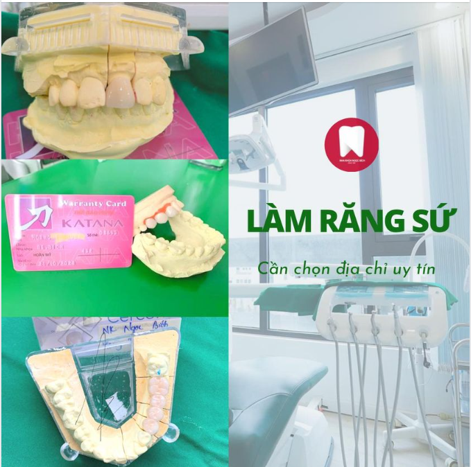 Làm răng sứ - đừng ham rẻ mà tiền mất tật mang