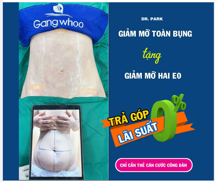 LIPO ULTRASOUND THÍCH HỢP GIẢM MỠ VÙNG NÀO