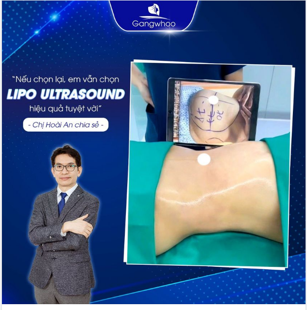 LIPO ULTRASOUND – VÌ SAO ĐƯỢC XEM LÀ “KHẮC TINH” CỦA MỠ THỪA