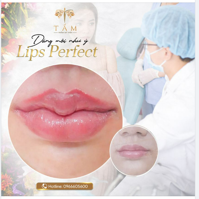 LIPS PERFECT - Tạo dáng môi ưng ý