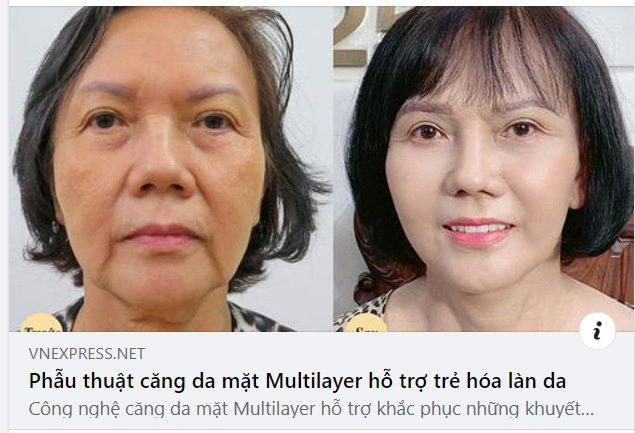 LỜI HỒI ĐÁP THANH XUÂN 2022