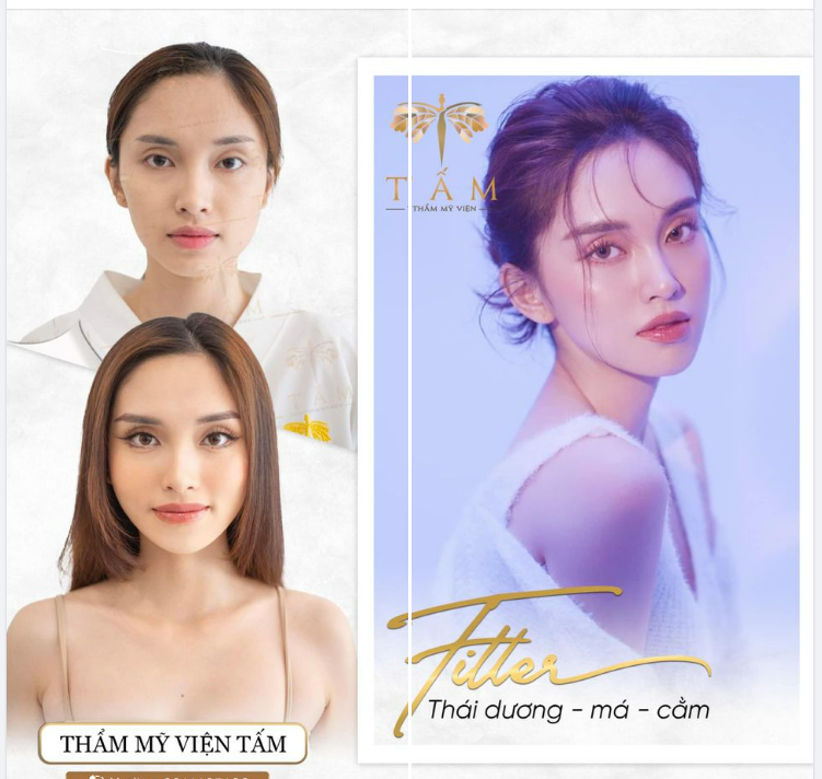 LỘT XÁC NGOẠN MỤC VỚI COMBO FILLER THÁI DƯƠNG - MÁ - CẰM