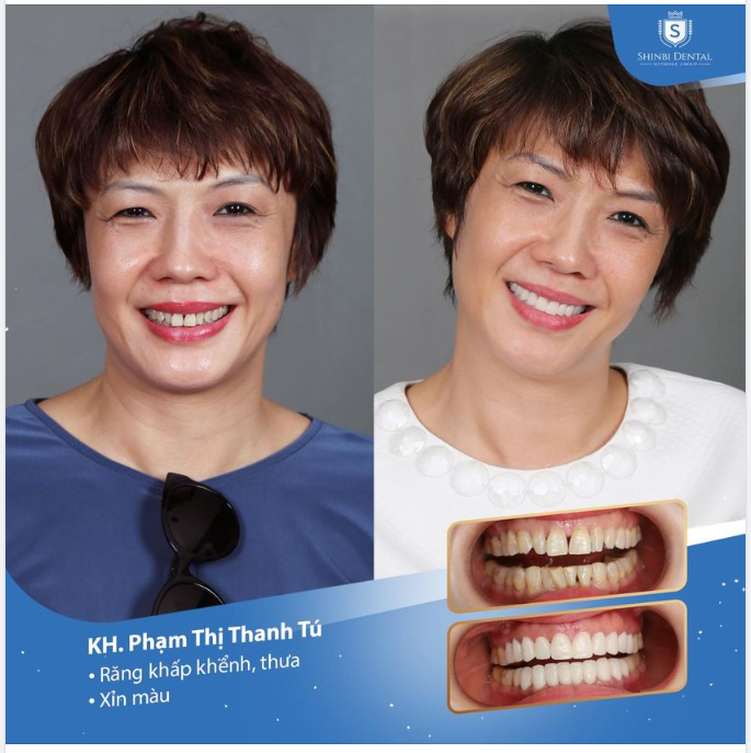 LỘT XÁC NỤ CƯỜI - RẠNG NGỜI NHAN SẮC
