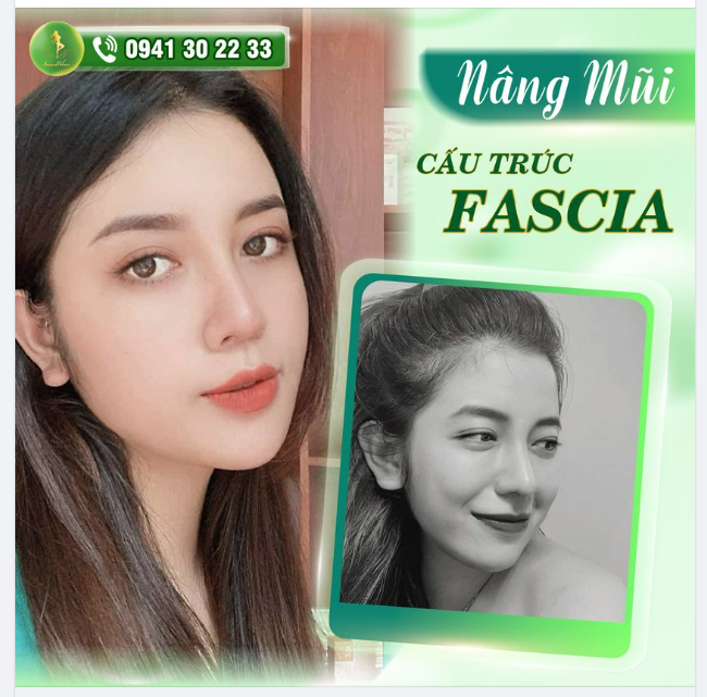 MÊ MẨN VỚI TOP 5 DÁNG MŨI ĐẸP THÁNG 9 CỦA SAIGON VENUS