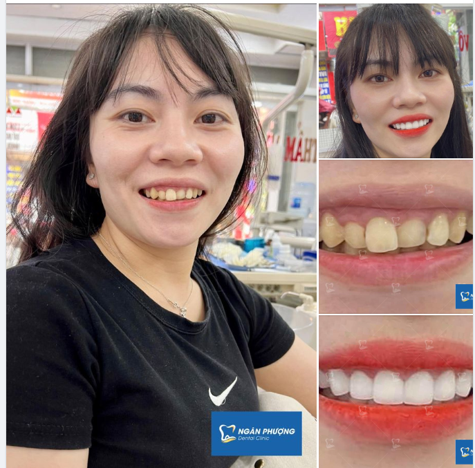 Mình về mình có nhớ ta - Ta về ta nhớ hàm răng mình cười