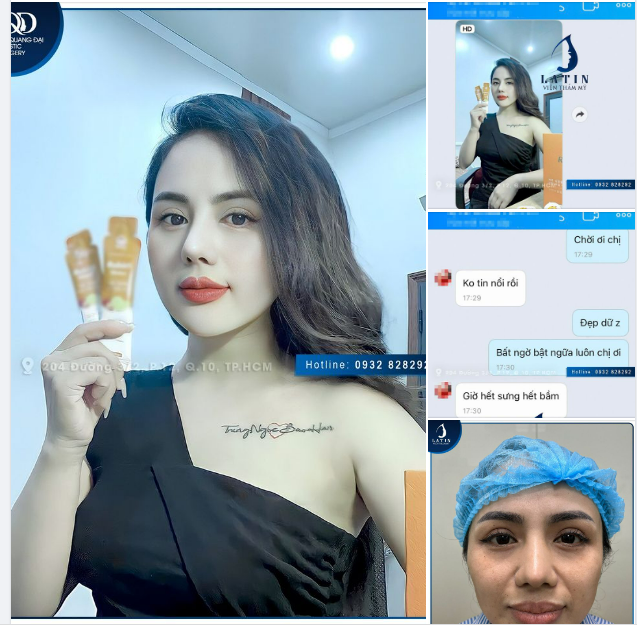 Một khuôn mặt, 2 dịch vụ - Combo nâng mũi, độn cằm nội soi tại Latin