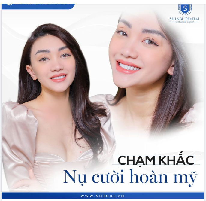 Một nụ cười đẹp có sức hấp dẫn không thể chối từ