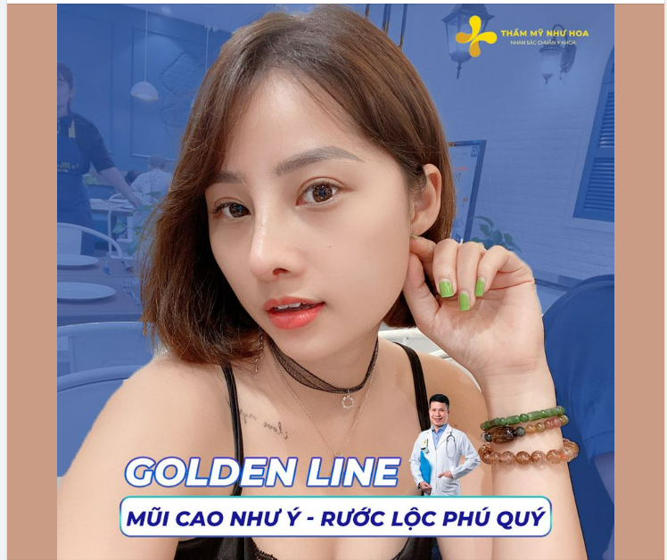 MŨI CAO NHƯ Ý - RƯỚC LỘC PHÚ QUÝ