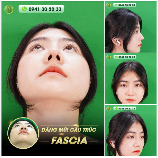 MŨI ĐẸP KHÔNG GÓC CHẾT - MŨI ĐẸP HOÀN HẢO ĐÚNG TỶ LỆ VÀNG