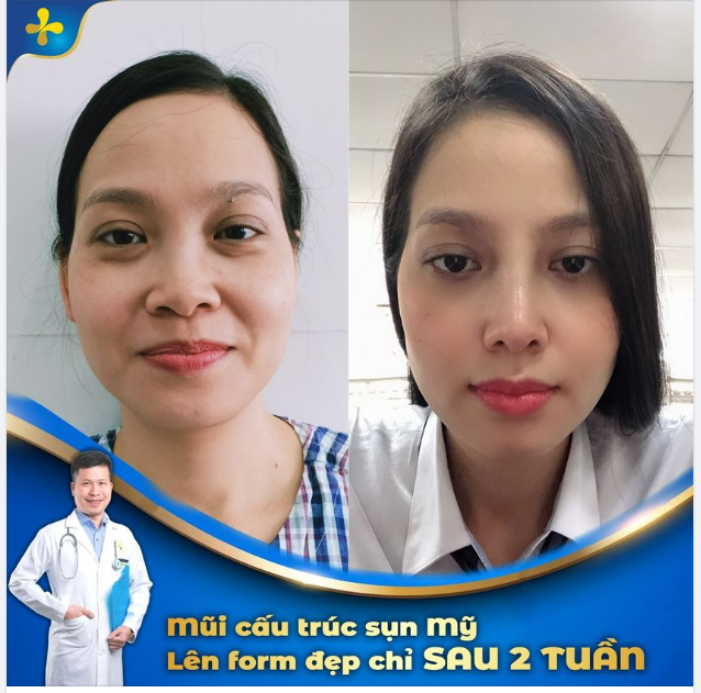 Mũi được xếp vào hàng ngũ quan, bên cạnh các bộ phần khác là lông mày, mắt, tai và miệng; có liên quan đến vận mệnh, cuộc đời của mỗi người