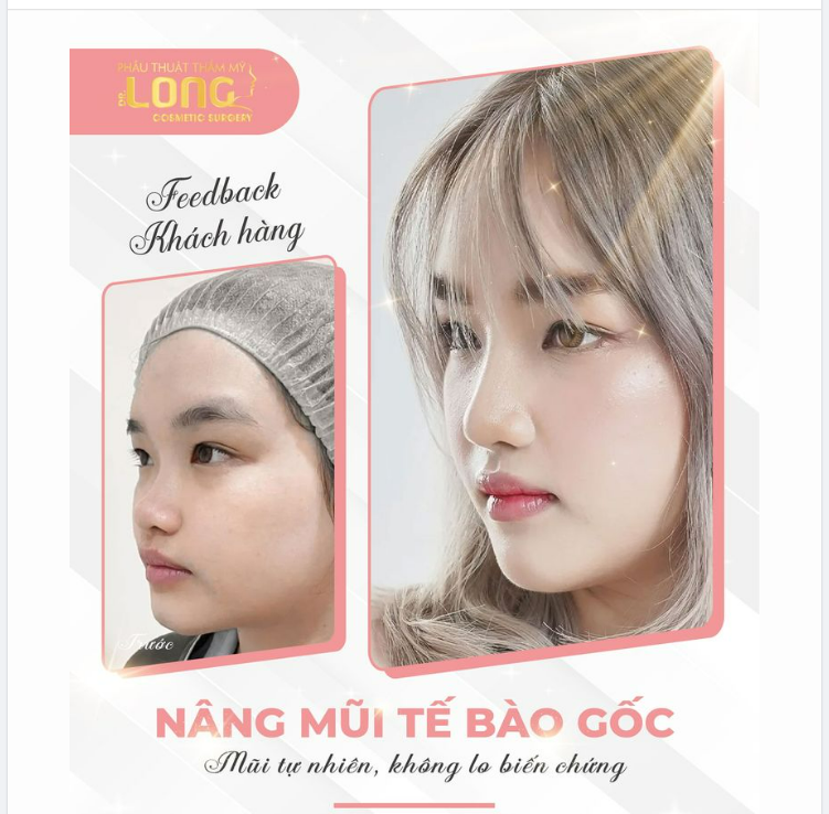MŨI TẾ BÀO GỐC  - CỨU TINH CỦA NHỮNG CA MŨI SỢ PHẪU THUẬT