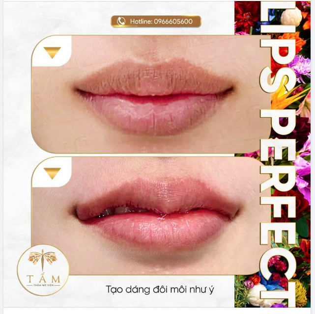 Muốn môi xinh như Hot girl ​​​​​​​ Đến Tấm ngay!!!