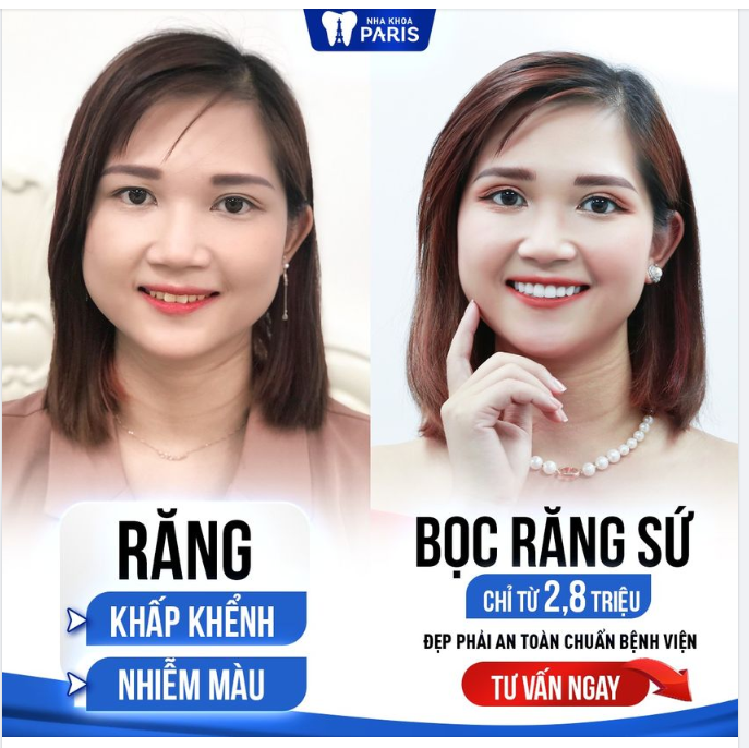 NÂNG CẤP NỤ CƯỜI - NÂNG CẤP BẢN THÂN