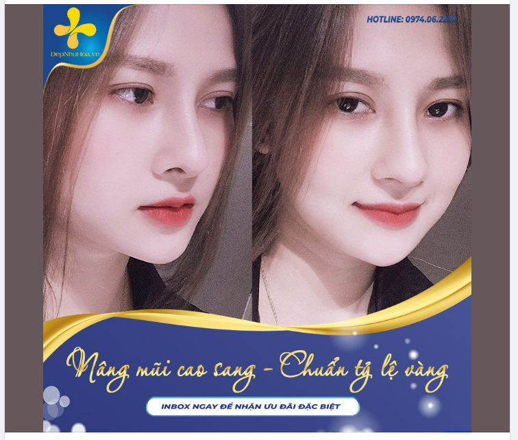 NÂNG MŨI CAO SANG - CHUẨN TỶ LỆ VÀNG