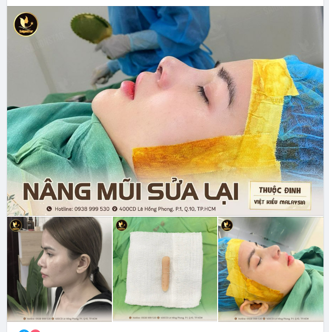 NÂNG MŨI CẤU TRÚC SỬA LẠI DR.HOẠT – ĐẸP 360 ĐỘ