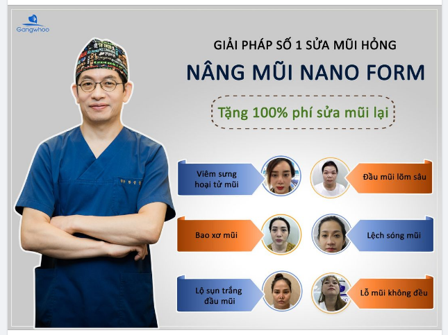 NÂNG MŨI NANO FORM - MŨI ĐẸP VĨNH VIỄN - ĐÓN NGÀN ĐIỀU MAY