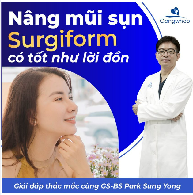 NÂNG MŨI SURGIFORM – KHI NÀO NÊN LỰA CHỌN