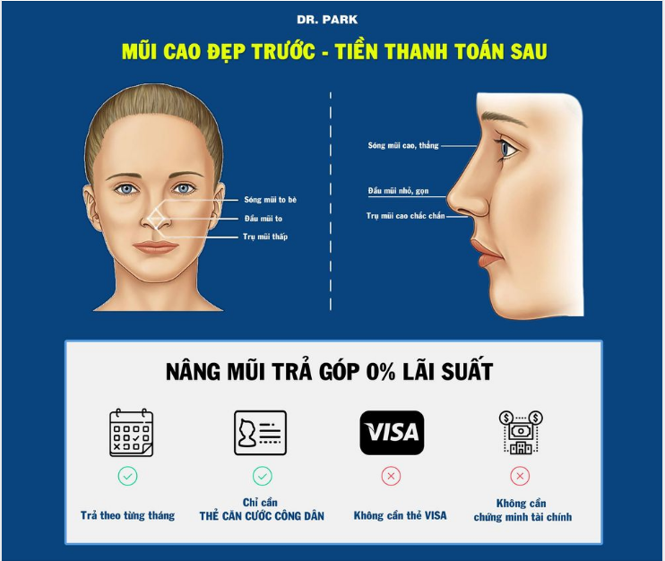 NÂNG MŨI TRẢ GÓP 0% LÃI SUẤT - MŨI CAO ĐẸP TRƯỚC - TIỀN THANH TOÁN SAU