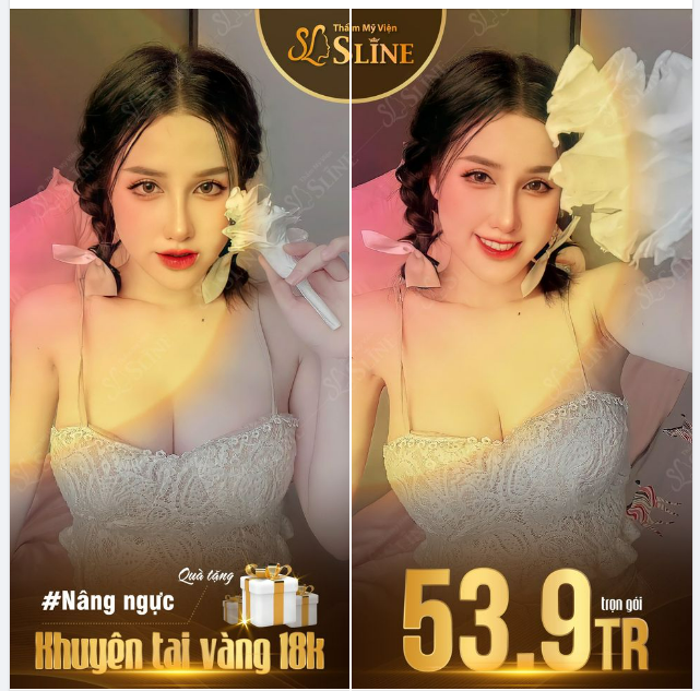 Nâng ngực chỉ còn 53,9tr trọn gói