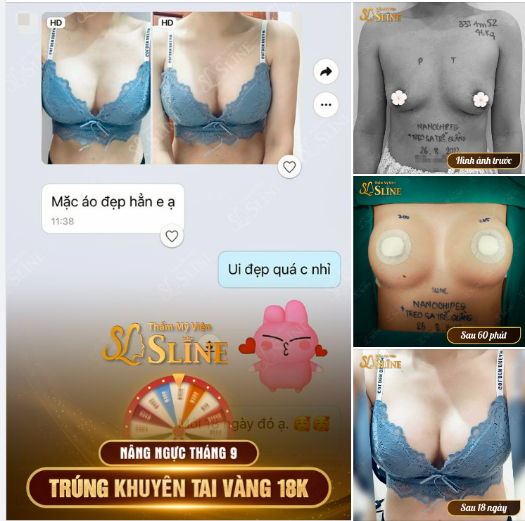 NÂNG NGỰC THÁNG 9.