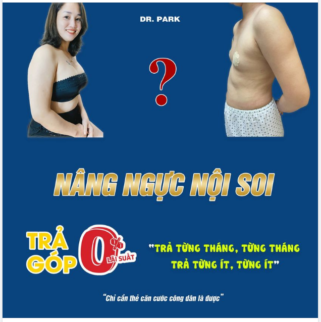 NÂNG NGỰC TRẢ GÓP - ĐỘ LOA TRƯỚC - THANH TOÁN SAU