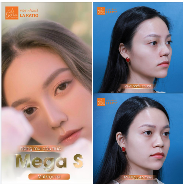 Nàng thơ Minh Trang với dáng mũi MỀM MẠI, THANH TÚ