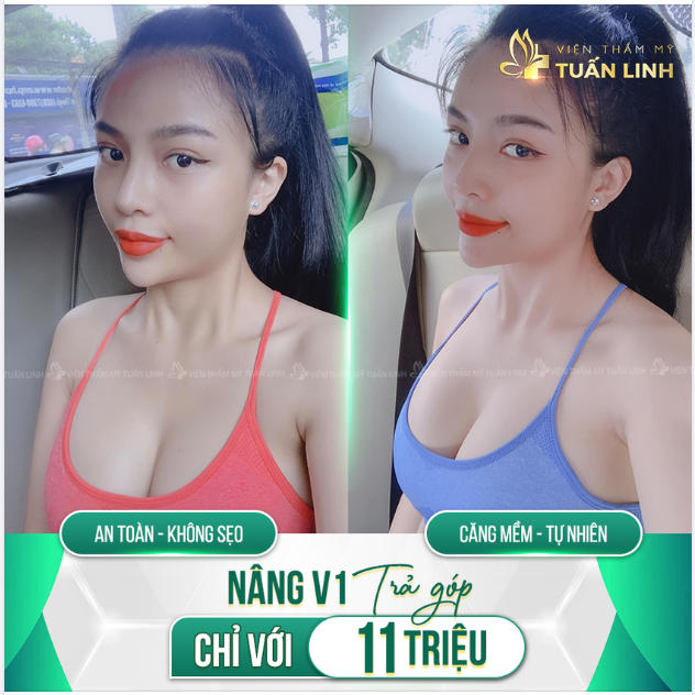 NÂNG V1 TRẢ GÓP VỚI 11 TRIỆU - 0 % LÃI !!!