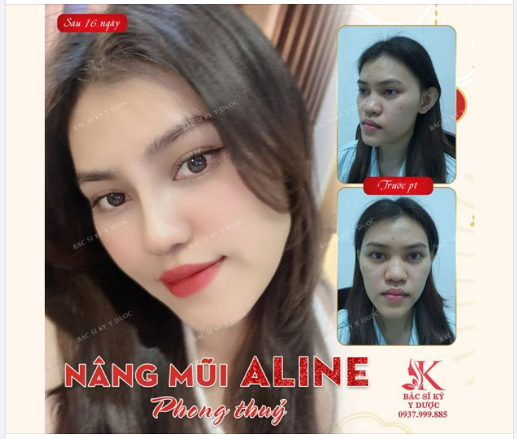 Nét đặc trưng của dáng mũi phong thủy là gì