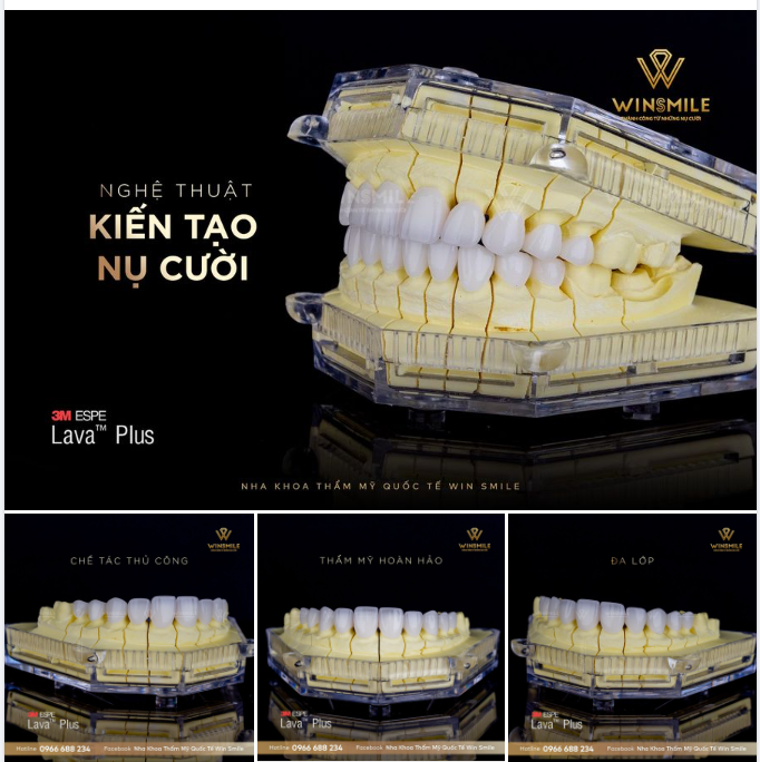 NGHỆ THUẬT KIẾN TẠO NỤ CƯỜI