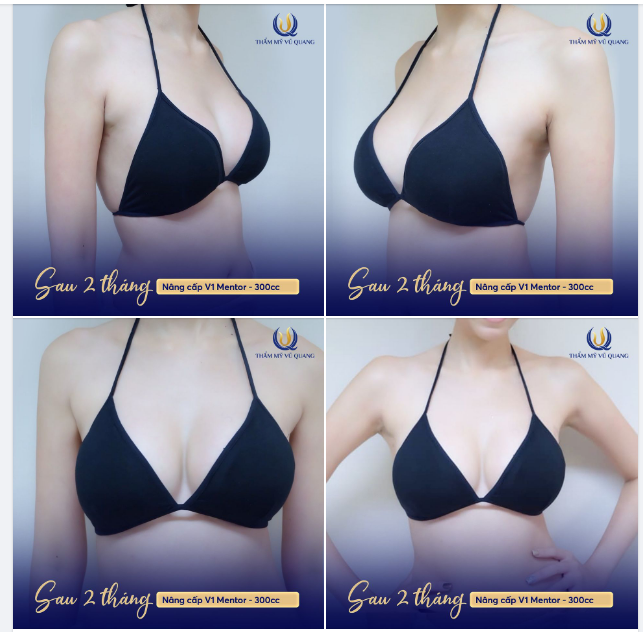 NGỰC ĐẸP MÊ LY - SEXY HẾT Ý