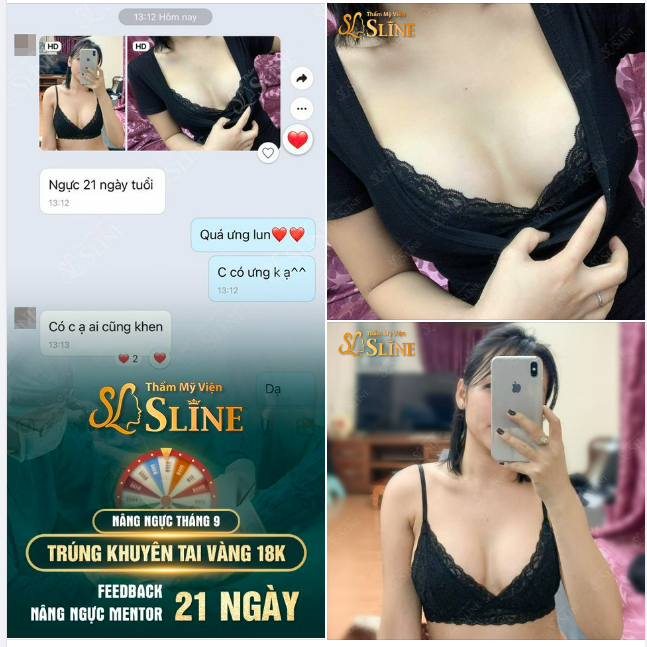 Ngực đẹp sau 21 ngày tuổi