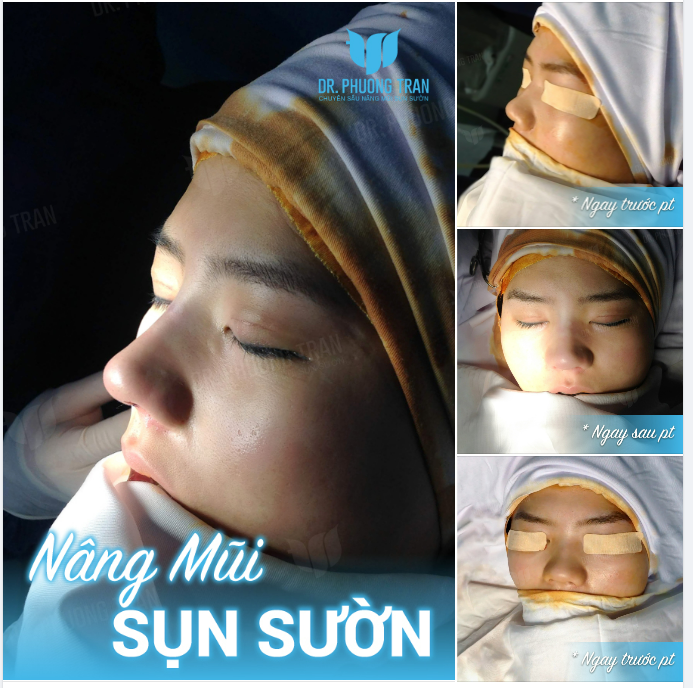 Người thương em sợ lo cho em ko đủ,.kẻ không thương thì sợ em đòi hỏi quá nhìu...!