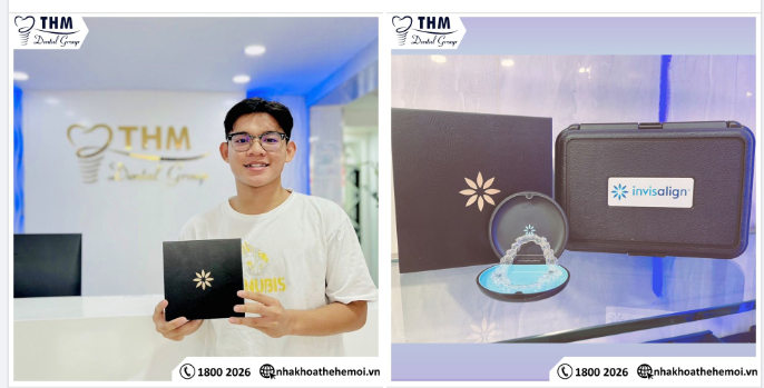 NHẬN KHAY INVISALIGN TẠI NHA KHOA THẾ HỆ MỚI
