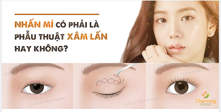 NHẤN MÍ LÀ PHẪU THUẬT KHÔNG XÂM LẤN LÀ ĐÚNG HAY SAI
