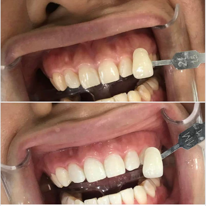“Niềm tin giống như một cục tẩy, nó sẽ càng ngày càng nhỏ đi sau mỗi lần sai lầm…”