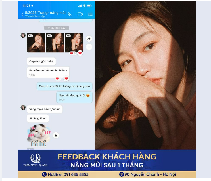 No makeup - No filter ở đây chỉ có một chiếc mũi Cấu trúc Softline đẹp mọi góc nhìn