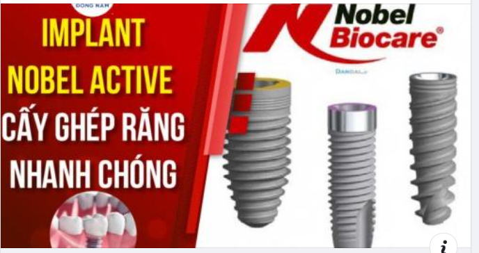 NOBEL ACTIVE - DÒNG IMPLANT DẪN ĐẦU VỀ ƯU ĐIỂM GẮN RĂNG TỨC THÌ