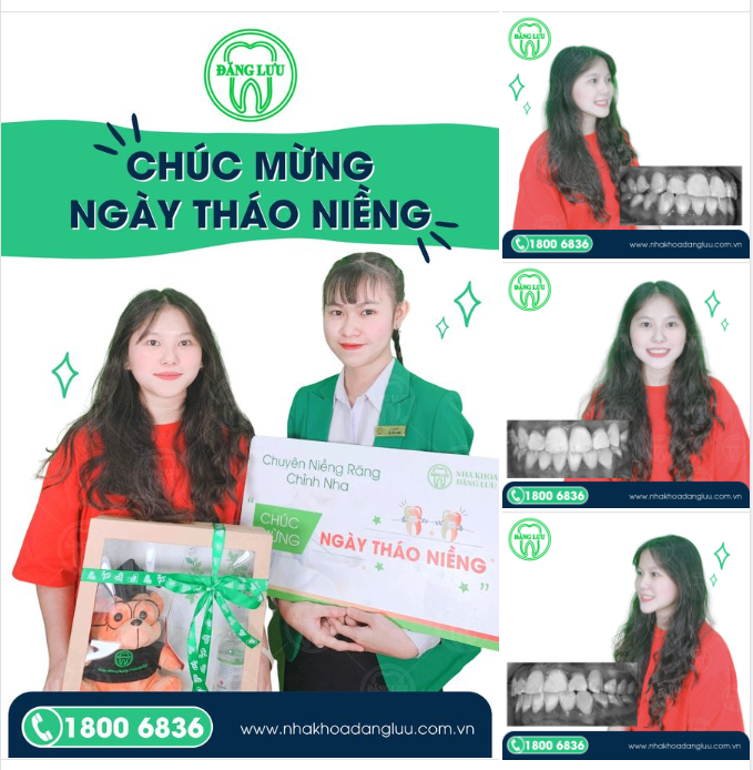NỤ CƯỜI THỨ 15.000 ++++