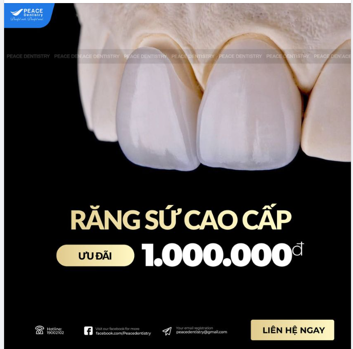 NỤ CƯỜI TOẢ NẮNG VỚI RĂNG TOÀN SỨ CAO CẤP
