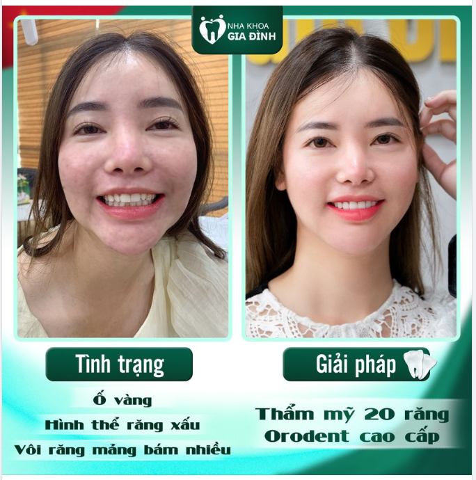 NỤ CƯỜI TƯƠI TẮN - NHAN SẮC LÊN HƯƠNG