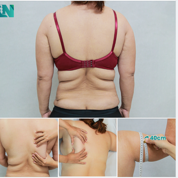 NỮ DOANH NHÂN 7X, TIN TƯỞNG GIẢI PHÁP GIẢM MỠ AN TOÀN.