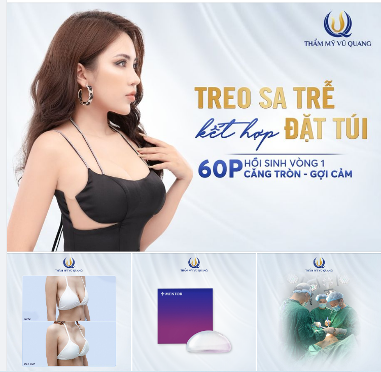 NÚI ĐÔI CHẢY NHƯ MƯỚP cũng trở nên CĂNG TRÒN nhờ Combo Treo sa trễ Kết hợp Đặt túi.