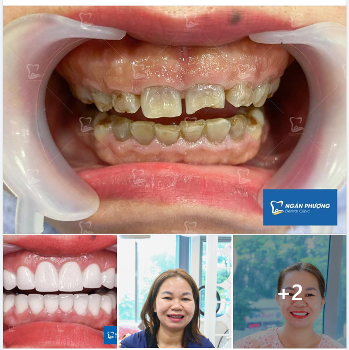 Phải nhờ nốt ruồi làm dấu, các bác sĩ mới nhận ra đây là cùng một người