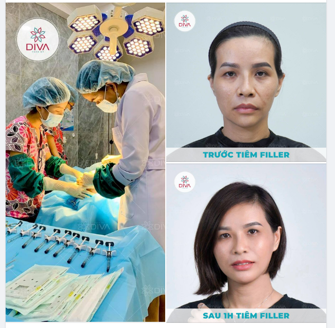 PHƯƠNG PHÁP NÀO NGĂN NGỪA LÃO HÓA ĐỘNG HIỆU QUẢ