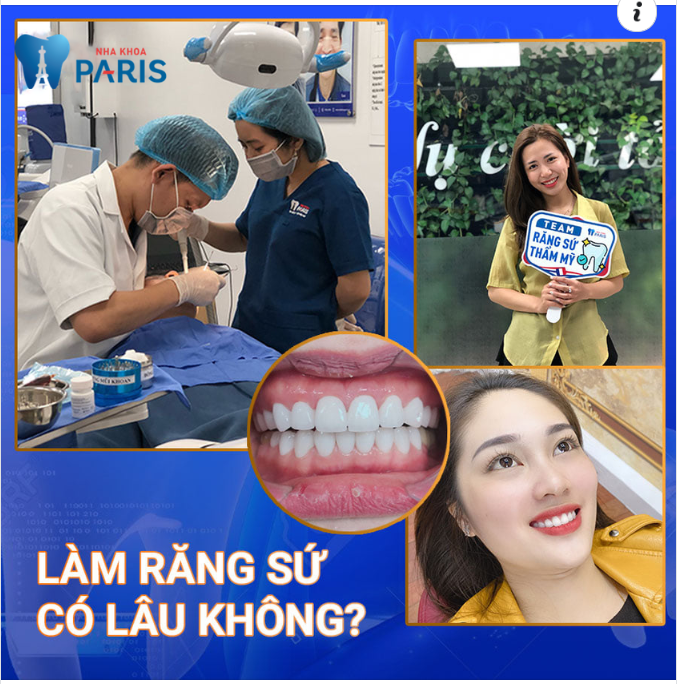 QUY TRÌNH LÀM RĂNG SỨ -  2 BUỔI ĐẸP NGAY 